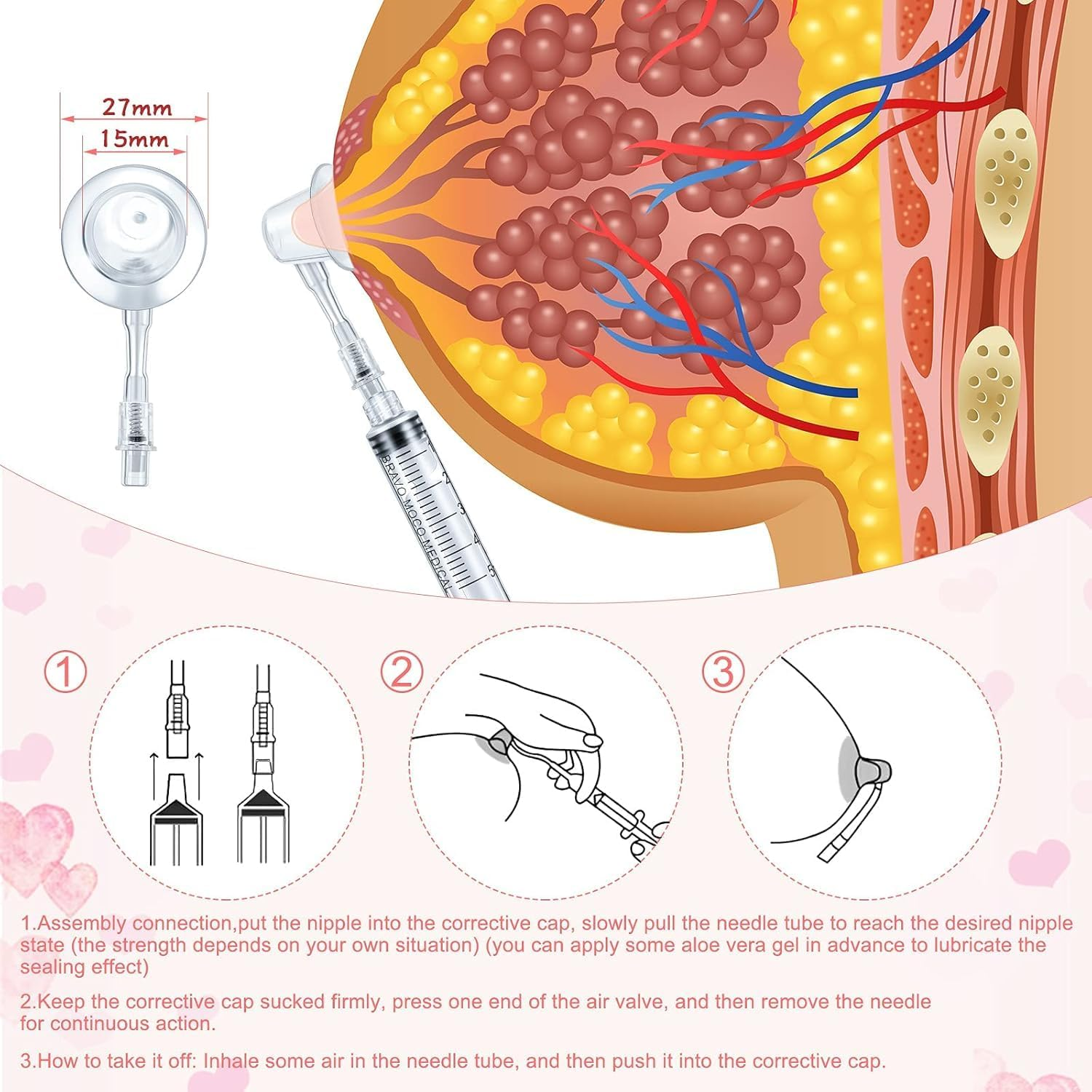 Nipple Corrector, Suction Device, Traction Suction Cup with Syringe, Capacity 10Ml image number 1
