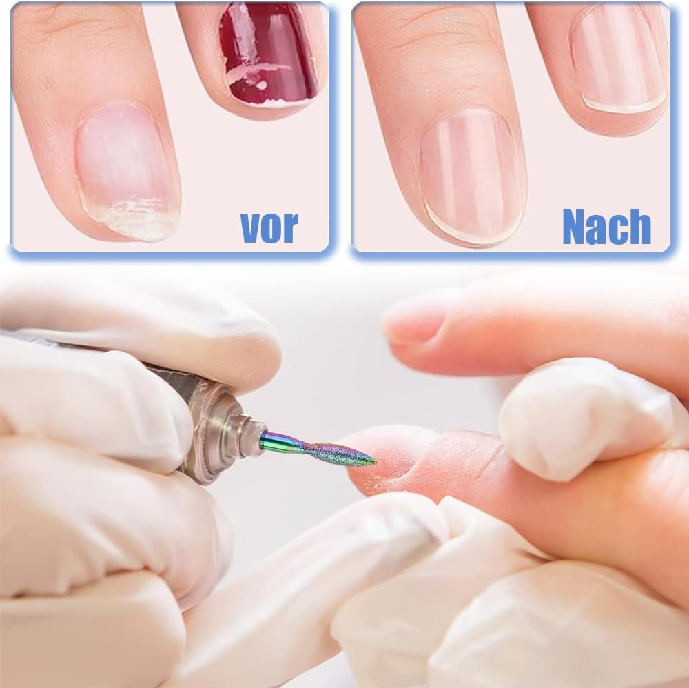 Mesee Pack of 20 Diamond Ceramic Bits, Nail Drill Bit, Acrylic Nail Drill Bit, Tungsten Alloy Professional Nail Drill Bits, Nail Cutter Attachments for Home, Salon, Manicure, Pedicure Tools image number 3