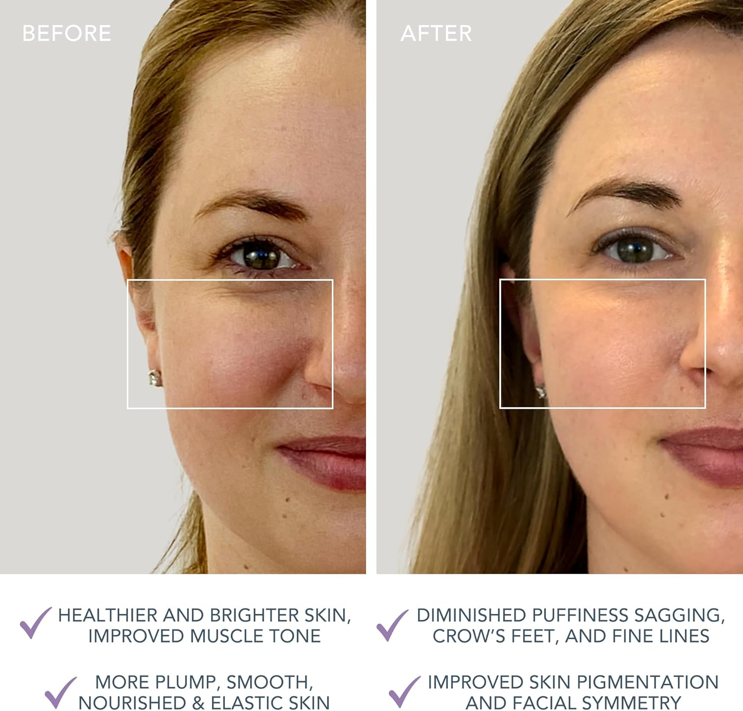 FOREO BEAR Mini Microcurrent Facial Device | 3 Microcurrent Intensities | Anti-Shock System | 90 Uses/Usb Charge | App-Connected | 2-Year Warranty | Lavander image number 4