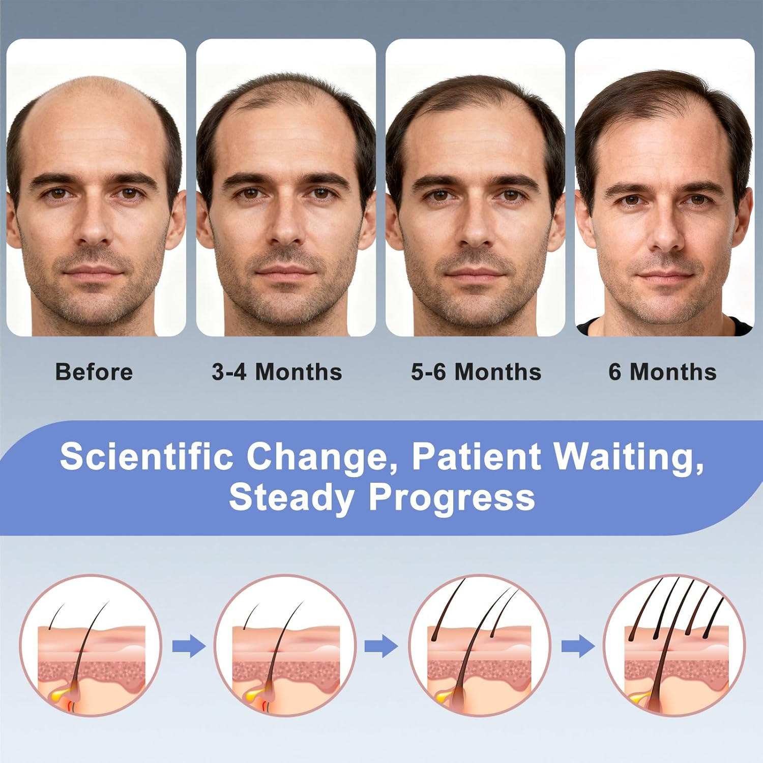 Etyceun Red Light Hair Growth Cap, Hair Growth and Anti-Hair Loss, 4 Modes with Removable Panel, 630 Nm + 450 Nm + 850 Nm, Hair Growth Cap, Adjustable Size, Hair Growth Acceleration for Men/Women image number 2