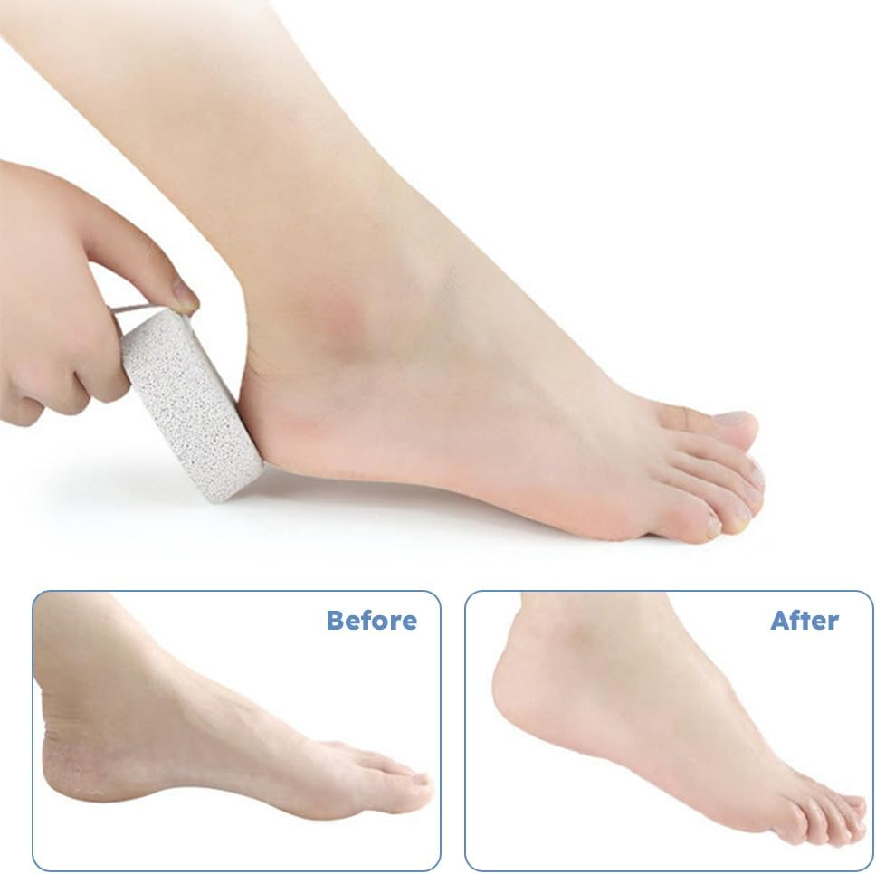 2PCS Natural Foot Pumice Stone for Feet,Lava Pedicure Tools Hard Skin Callus Remover for Feet and Hands,Foot File Exfoliation to Remove Dead Skin,And Callusess image number 6