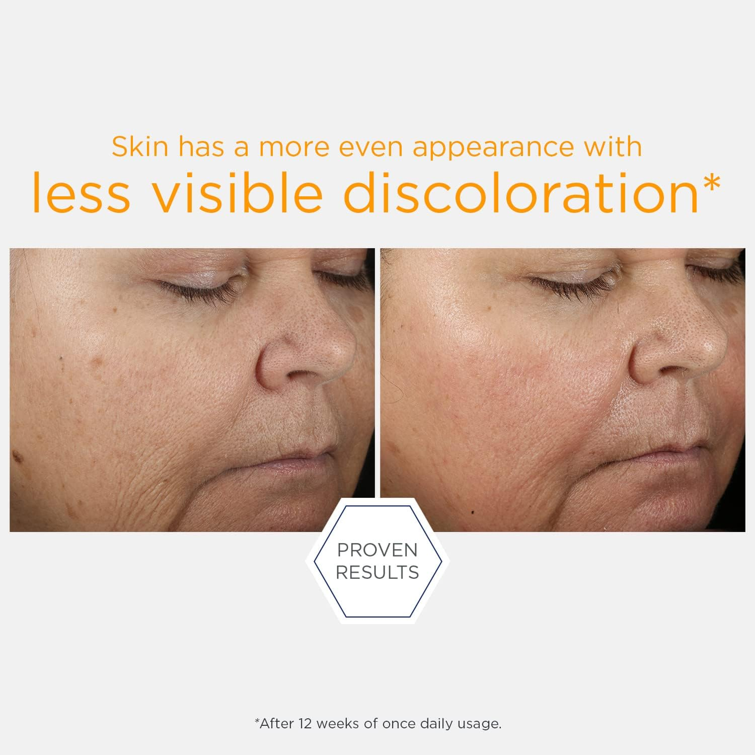 NEOSTRATA 15% Vitamin C Face Serum, PHA + Green Tea Brightening Serum, 0.5 Fl. Oz. image number 6