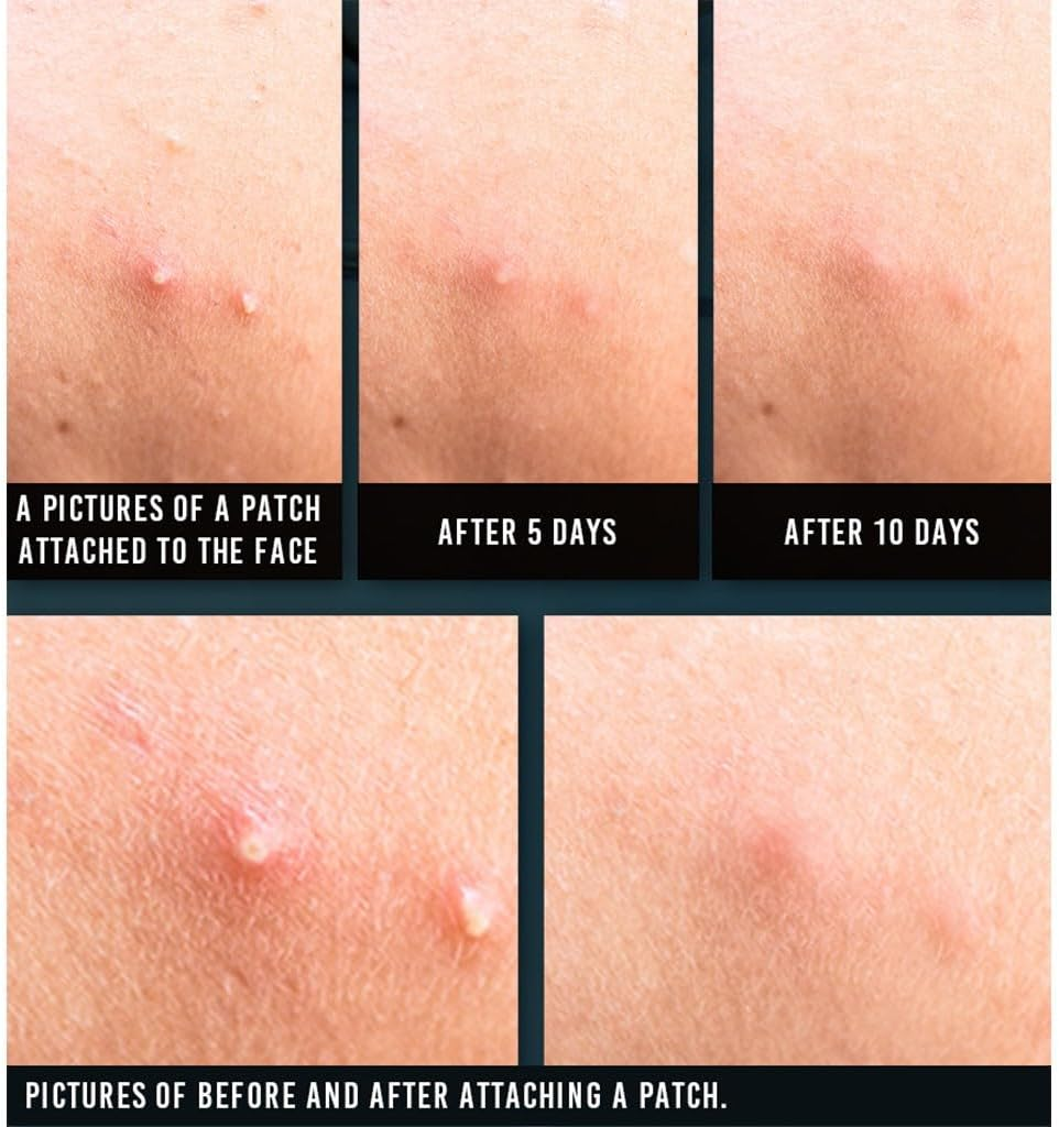 PYUNKANG YUL Acne Spot Patch Super Thin image number 1