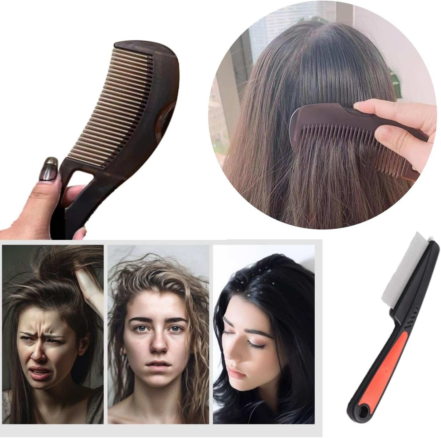 Shoyisenka Stainless Steel Fine Tooth Comb&ndash;Scalp Psoriasis & Dandruff Remover, Detox & Lice Comb for Men & Women (A Set of Three)