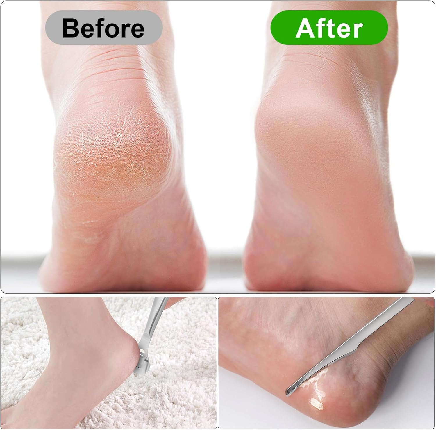 Callus Remover, Foot Scraper, Stainless Steel Callus Planer with 10 Replacement Blades Silver and 3 Foot File Scraper, Callus Removal, Foot Callus Rasp, Pedicure Set, Foot Care for Wet and Dry Feet