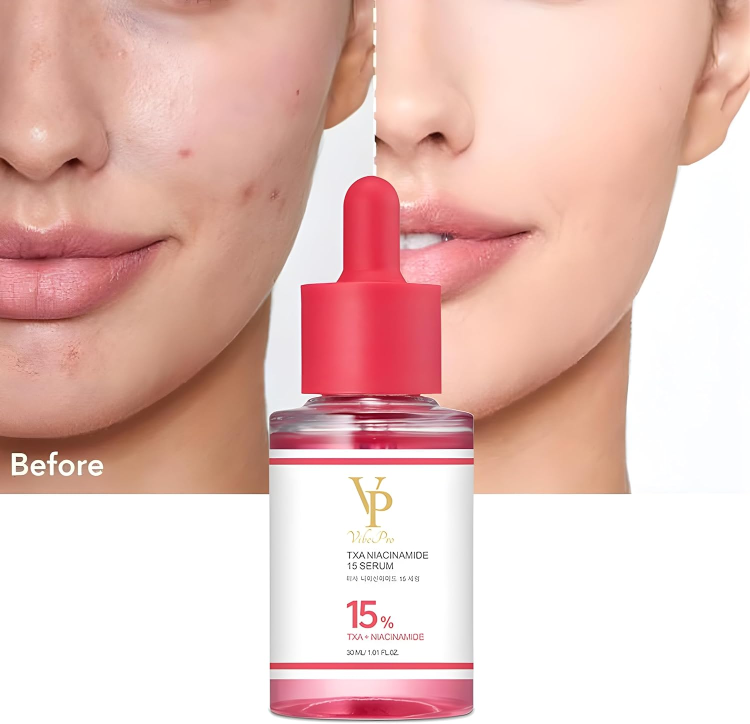 Vibepro TXA Niacinamide 15% Serum, Professional Facial Treatment Serum, Hydrating Formula for Radiance and Even Tone, Anti-Wrinkle Skincare Solution, Korean Skincare, 30Ml - Vibepro image number 2