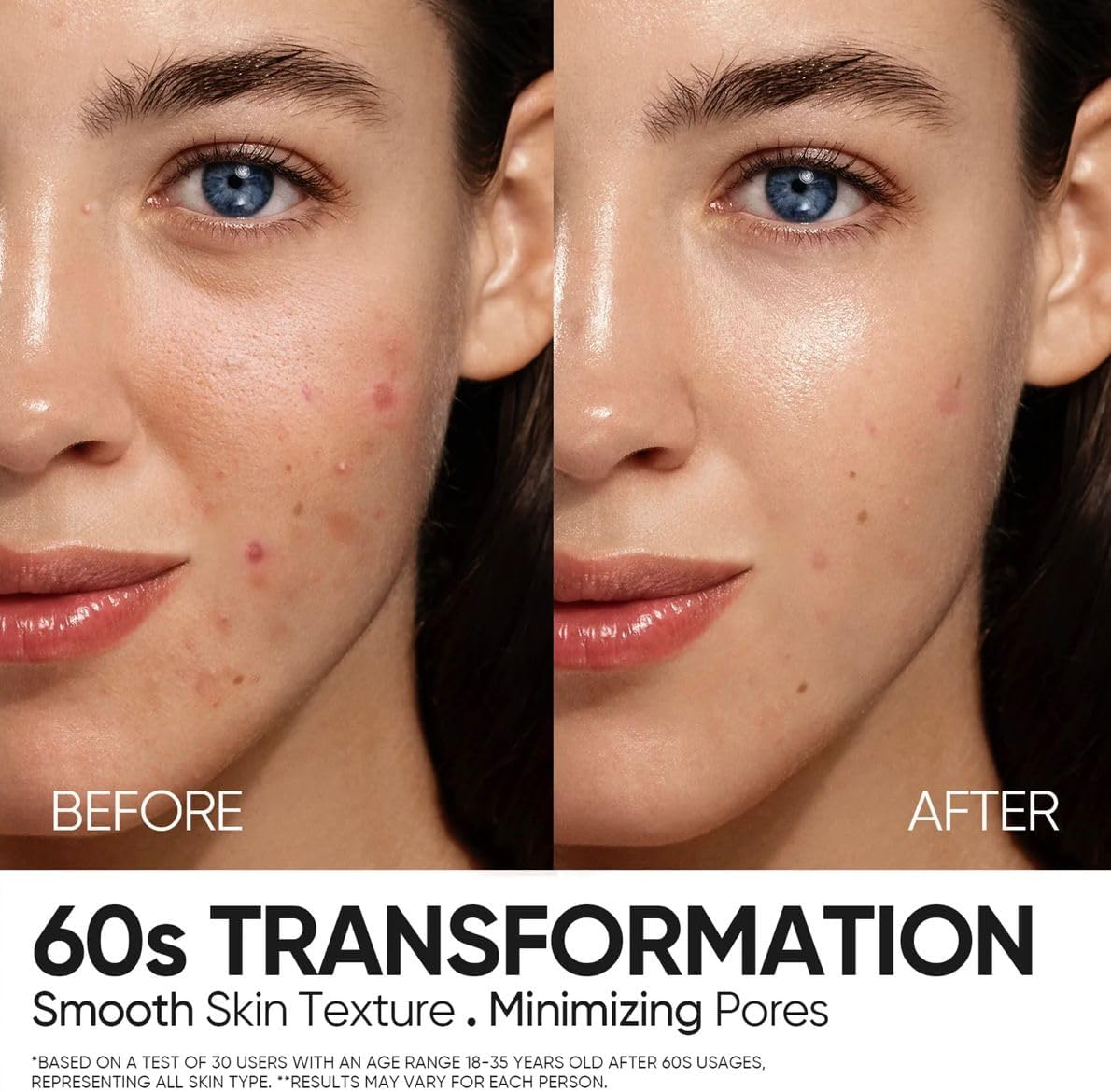 SKINTIFIC 12% AHA BHA PHA LHA Peeling Solution Serum 30Ml image number 5