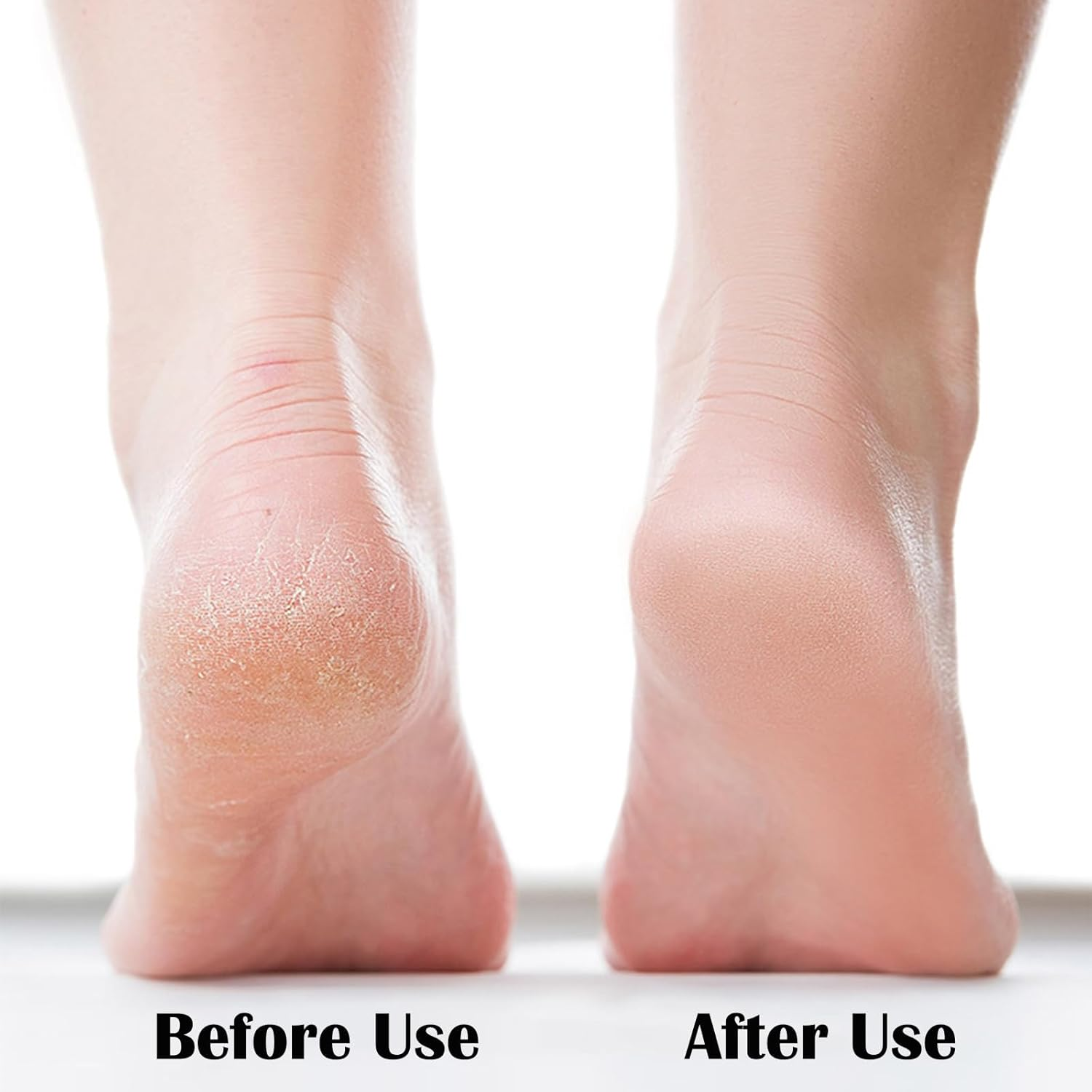 Nano Foot File, Foot Scrubber Callus Remover, Foot Care Pedicure Tool, Foot File with Nano-Level Grinding Points, Portable Foot Scrubber for Dead Skin Removal, Cracking, Wet and Dry Feet image number 3