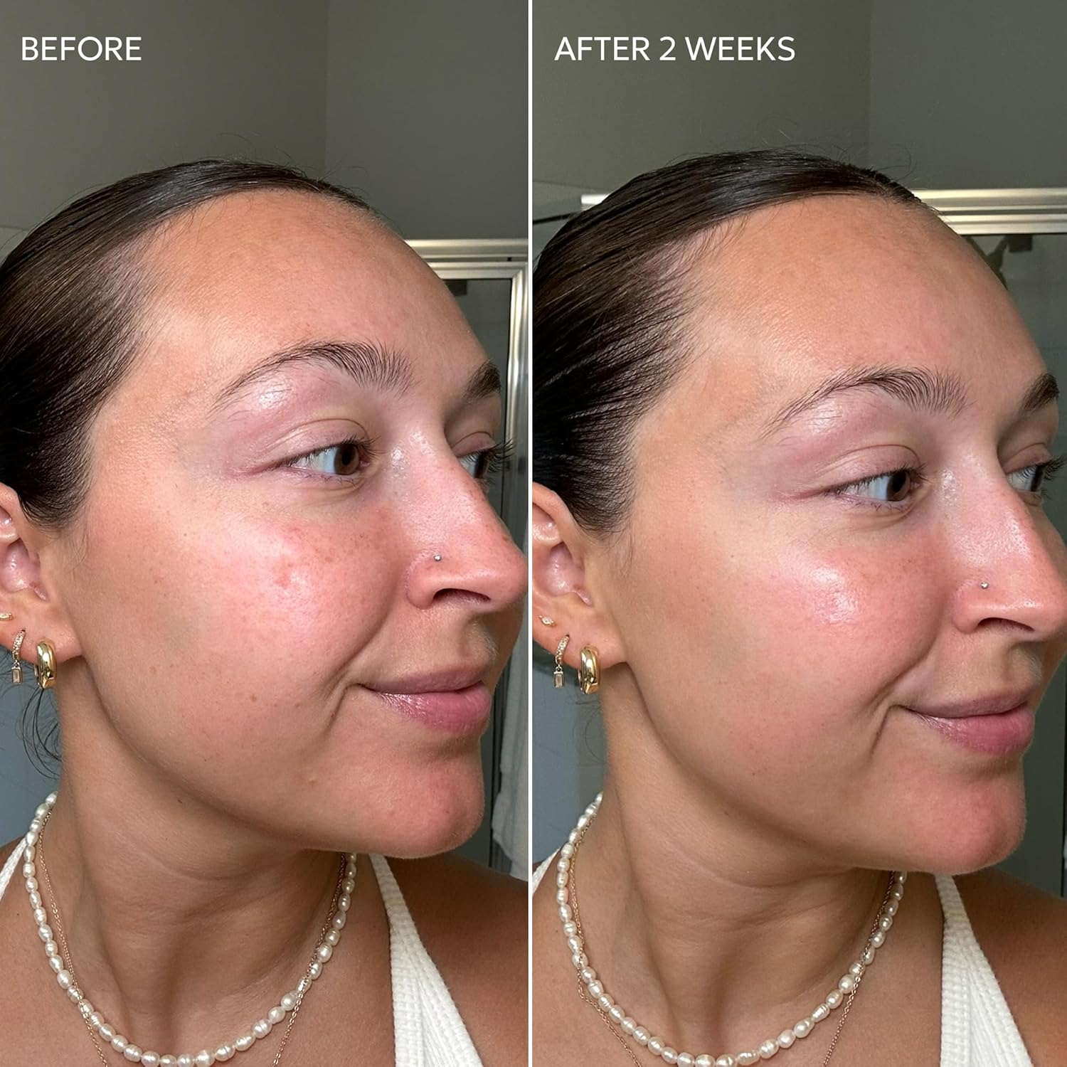 Skin Fade Cream by Dermisa for Unisex - 1.78 Oz Cream image number 2