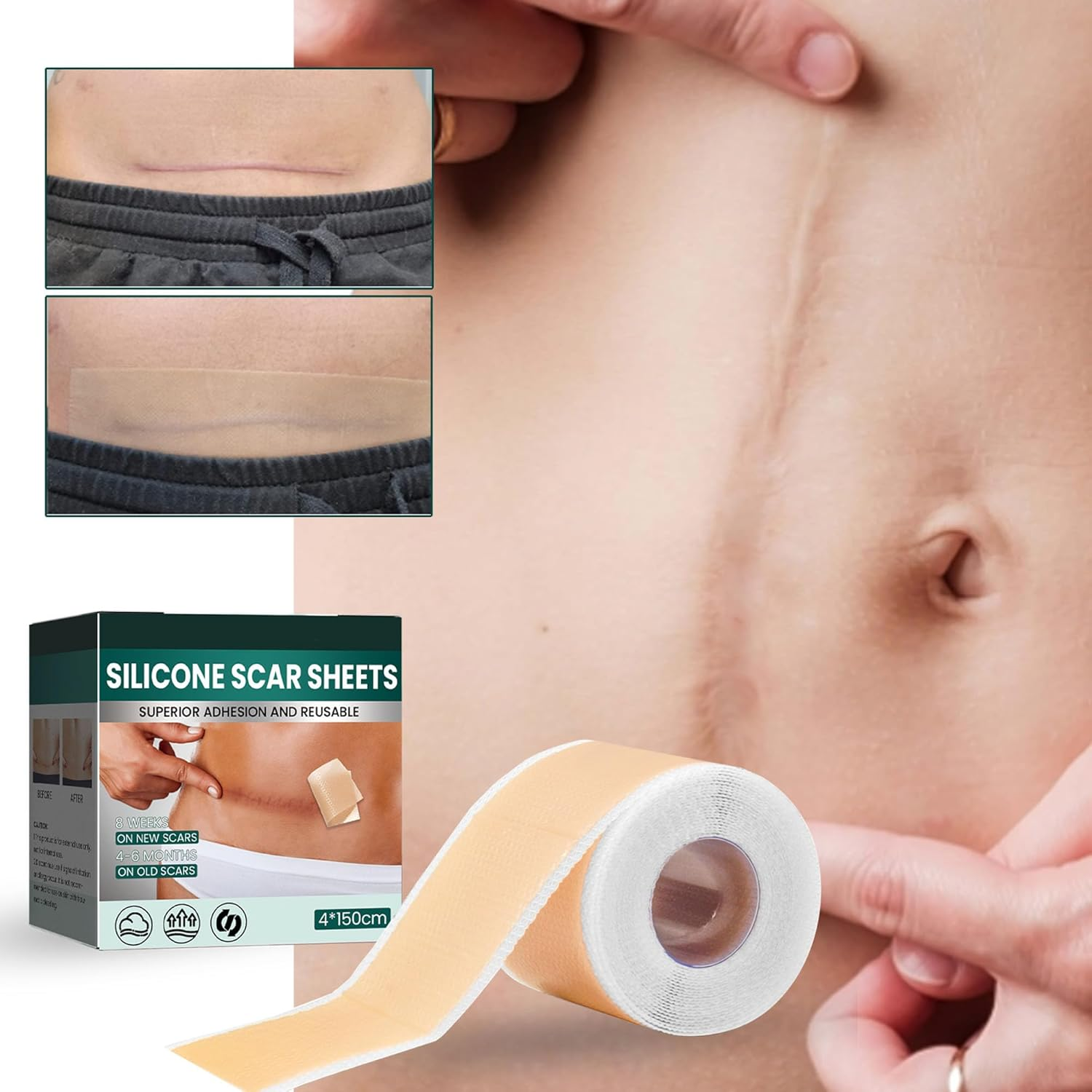 Silicone Scar Tape, Soft Silicone Scar Tape Painless Silicone Tape Roll for Surgical Keloid and Acne Scars (4 * 150Cm) image number 3