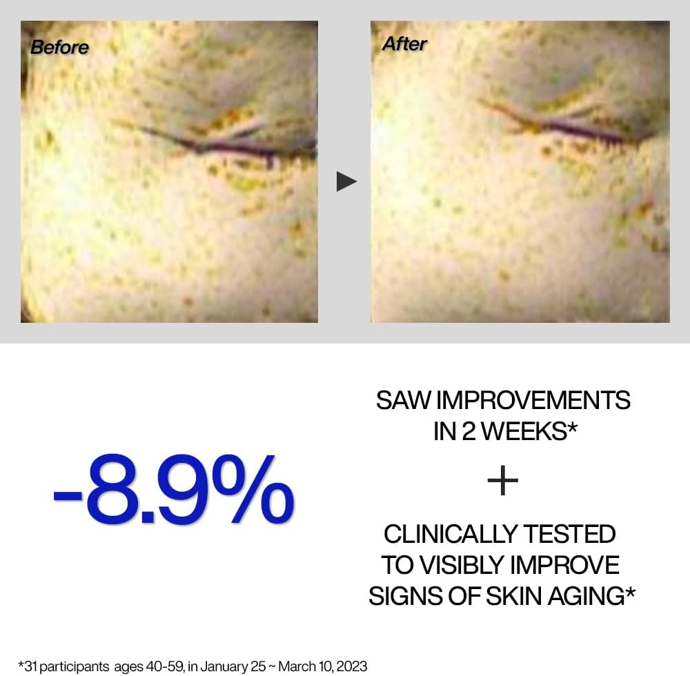 Iope Retinol Expert 0.1% Wrinkle Corrector 30 Ml image number 5