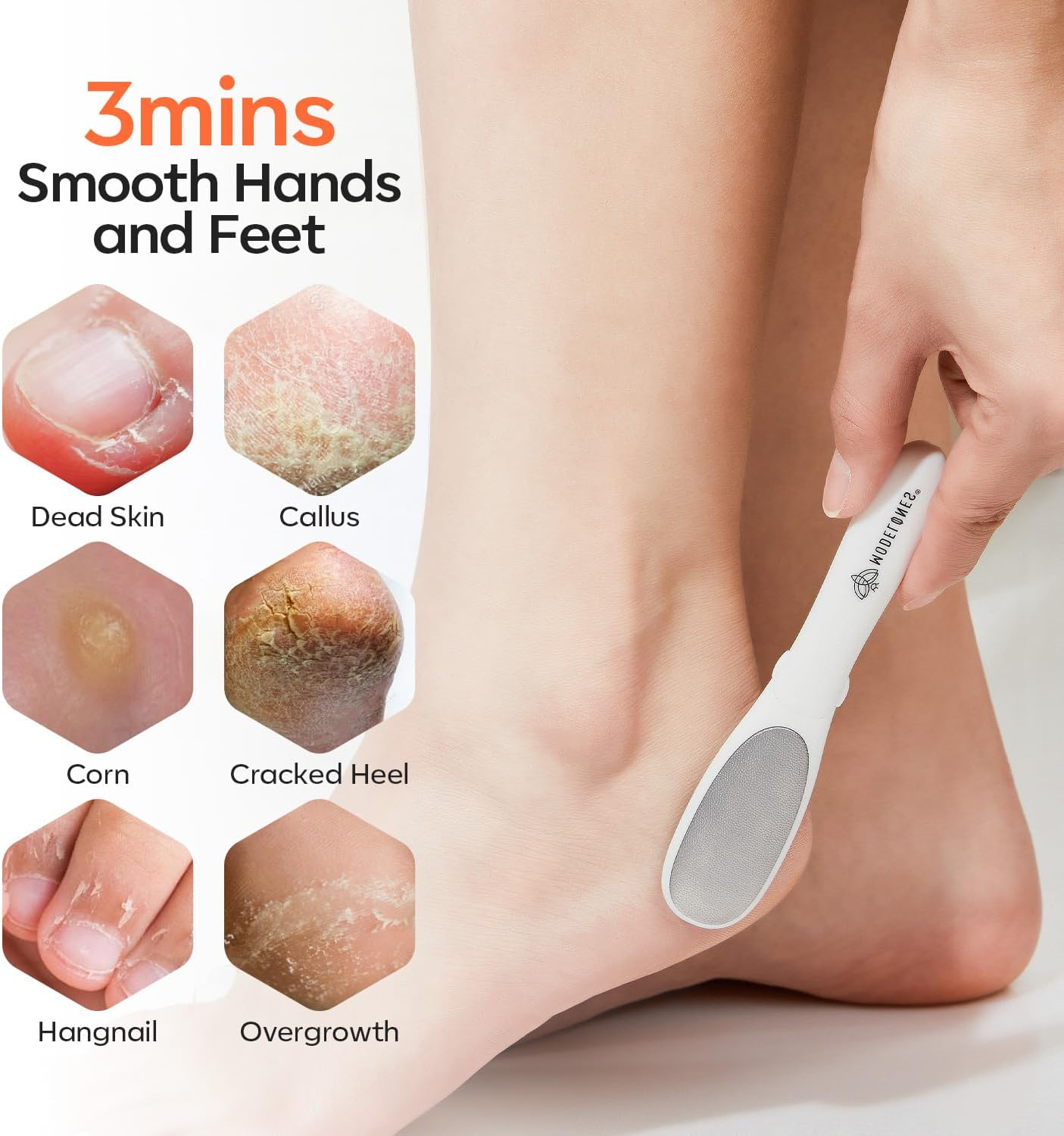 Modelones Mini Foot File Callus Remover, Multifunction 2-In-1 Pedicure Tools for Feet with Double-Sided Foot Rasp, Dead Skin Fork - Safe, Lightweight Foot Sander Perfect for Daily Hand & Foot Care image number 5