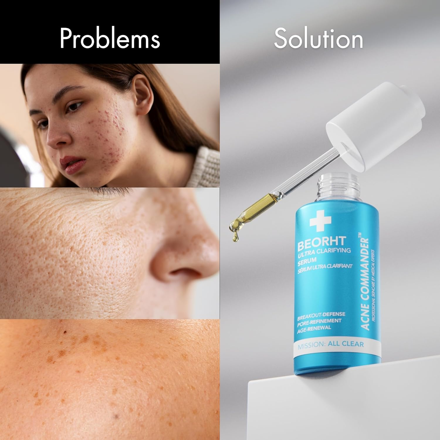 Ultra Clarifying Age-Renewing Serum &ndash; Helps Reduce the Appearance of Blemishes & Marks &ndash; Face Serum for Blemish-Prone Skin &ndash; Smoothing & Anti-Aging Serum &ndash; 1 Fl Oz image number 4