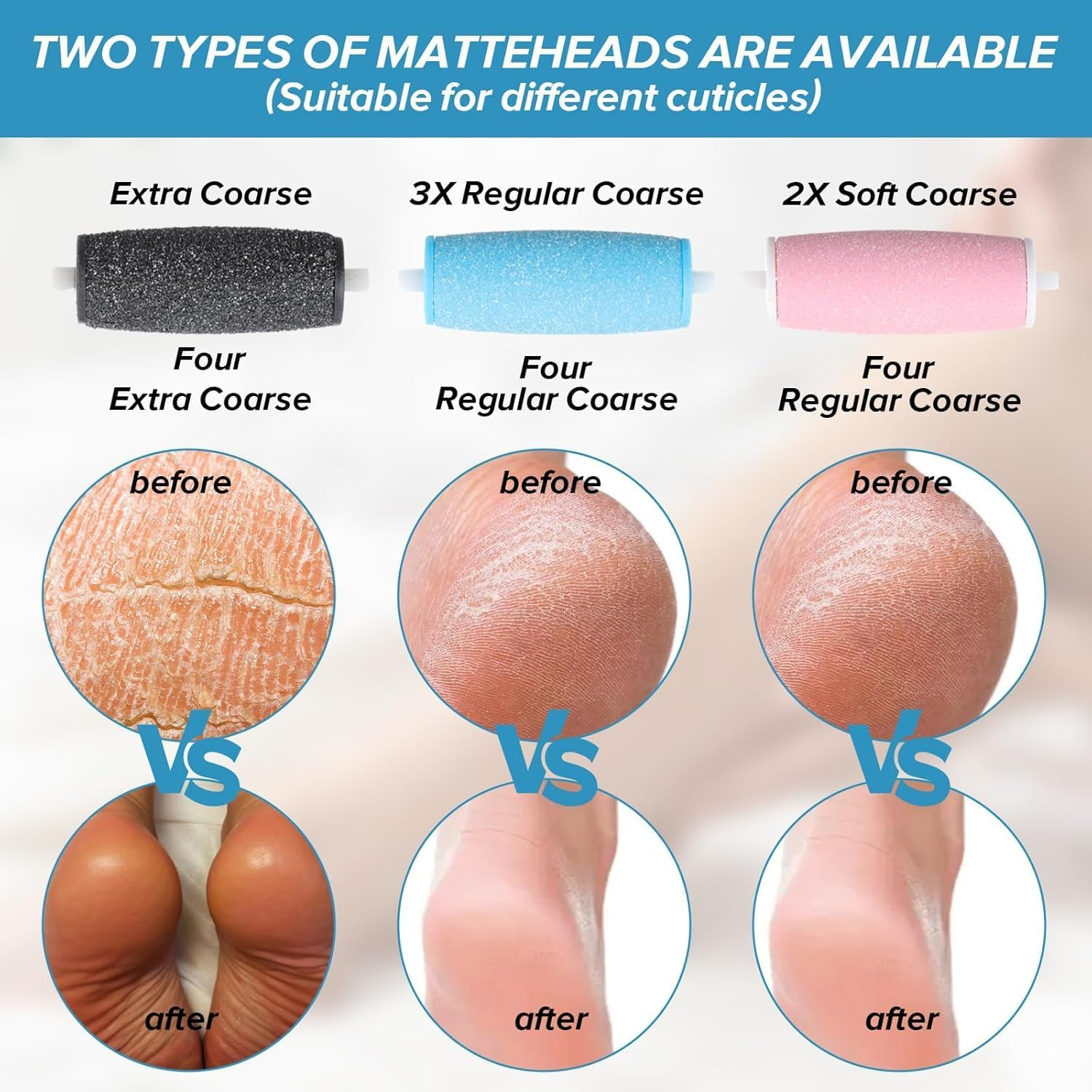 Frosted Replacement Roller Refill Heads, 12Pcs Foot File Roller Head Refills Callus Remover, Smooth Pedi Foot File Roller Refills Replacement Heads for Foot Scrubber Callus Remover image number 6