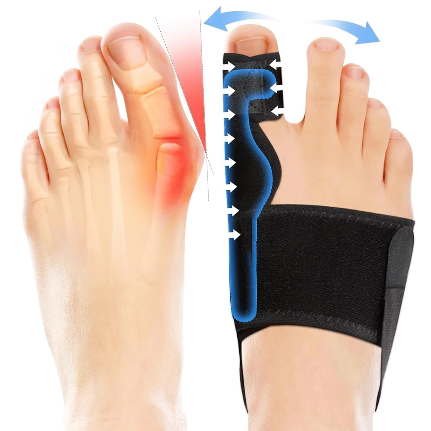 Effective Bunion Corrector for Women and Men | Relieve Pain, Straighten Toes, and Correct Bunions | Orthopedic Toe Straightener | Best Bunion Corrector for Lasting Relief - Day & Overnight Support (Right) image number 2