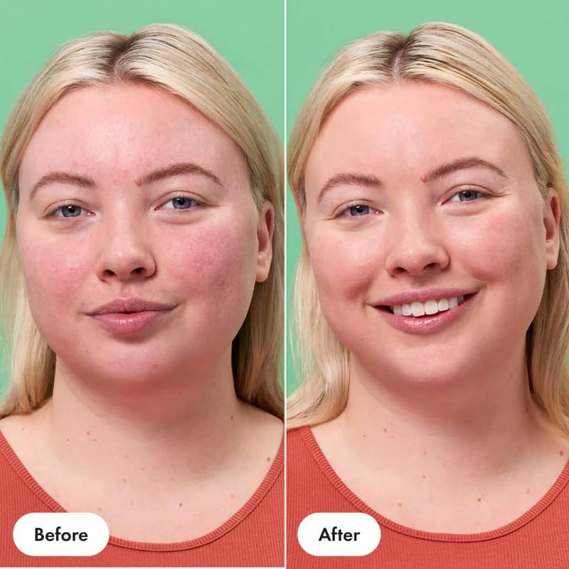 Hero Cosmetics Rescue Balm + Red Correct 15Ml | Color Correcting Green Balm Moisturiser for Redness, Post-Breakout Care, and Dry Skin Nourishment | Lightweight Primer for Fair to Medium Skin Tones