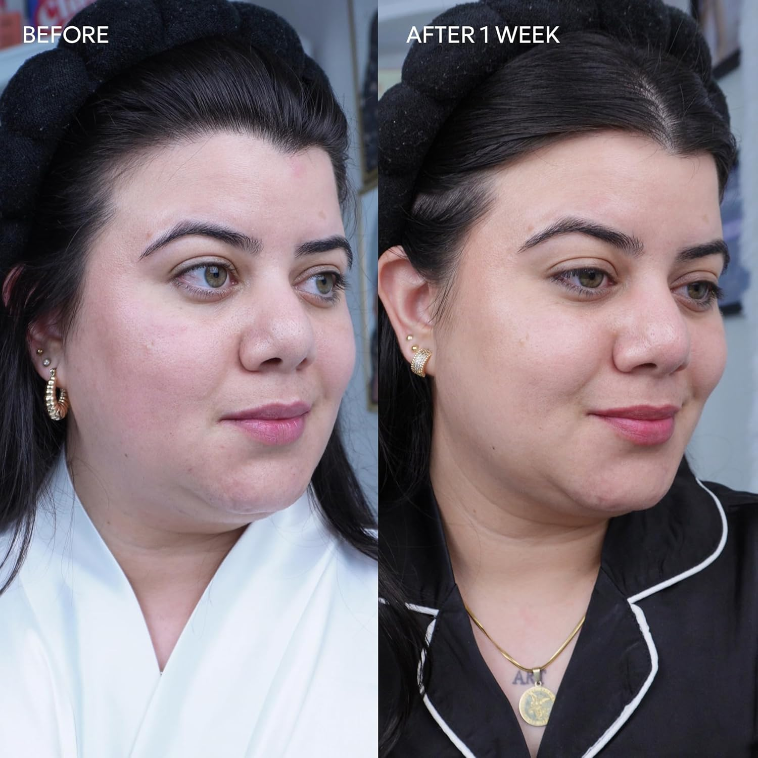 Dermisa Brightening Bar Soap, Natural Botanical Extracts, (3-Pack, Each of 3 Oz) image number 4