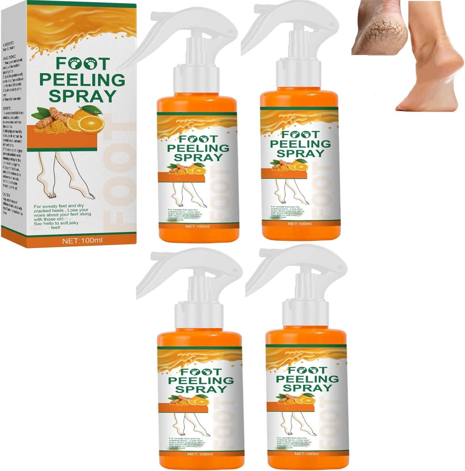 Foot Peeling Spray, Removal Dead Skin, Moisturized and Brighten Skin,Exfoliating Peeling Calluses on Feet, Smoothing Dry & Cracked Feet, Multi - Use for Hands & Joints,Knee,Ankle,Elbow (1PCS)