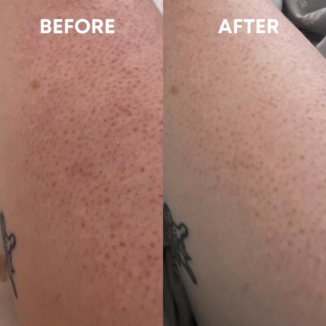 Cheekyglo Premium Exfoliating Glove (Black) | 100% Vegan Viscose Tradition Body Scrub Glove | Kessa Exfoliating Glove | Body Exfoliator | Self-Tan Removal | Keratosis Pilaris Exfoliation image number 6