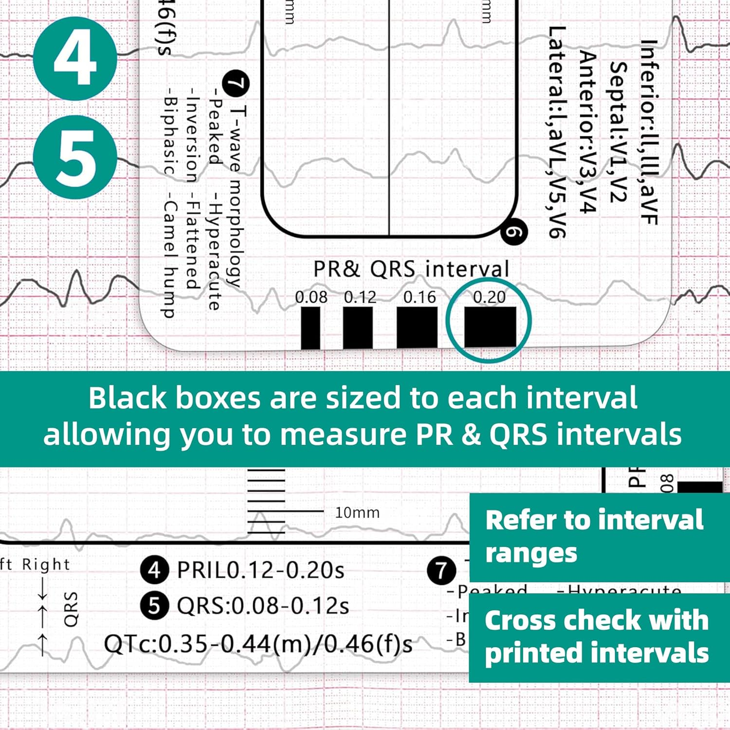 2 Pack Ecg-7-Step-Ruler - ECG/EKG Interpretation Tool, Portable Pocket Ruler, ECG Reference Guide, EKG Ruler Horizontal Badge Card Tool for Accurate Heart Rate and Interval Assessment