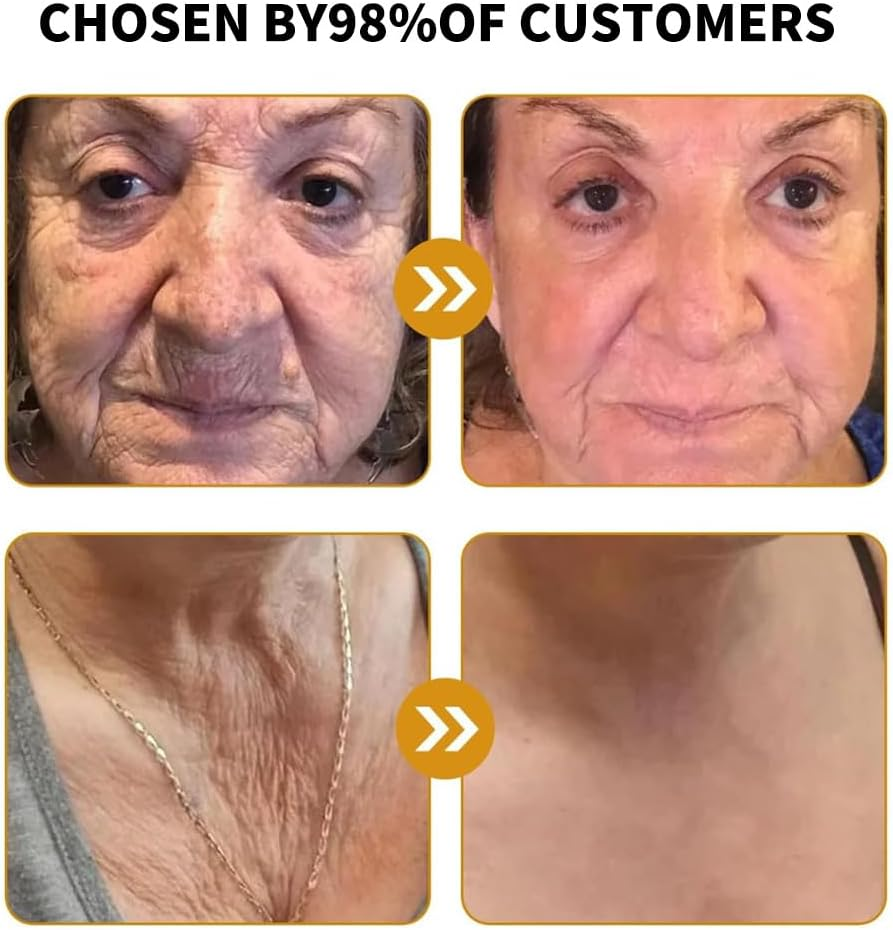 Depehelp Bee Venom Skin Treatment Cream, Face & Body Ointment - Comprehensive Moisturizer for Dry/All Skin Types, Natural Skin Restoration Formula