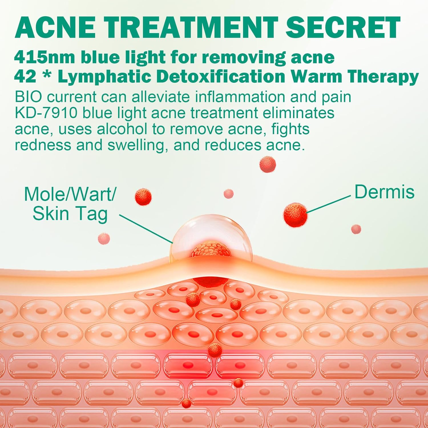 Non-Invasive Pen for Mole and Wart Removal, Blue Light Acne Remover, Wart Remover, Dark Spot Remover for Face and Body image number 2