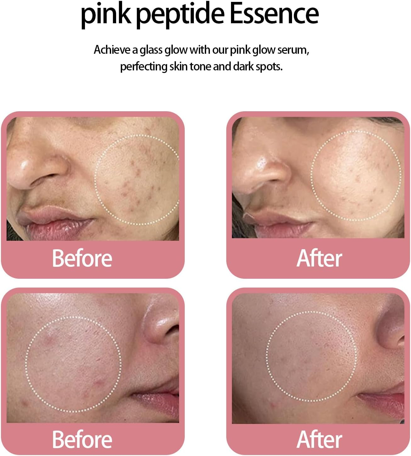 Salmon Dna Serum Face, Hydrating Peptide Serum, Gentle Facial Serum, Suitable for All Skin Types, Brightening, Moisturizing Daily Skincare image number 3