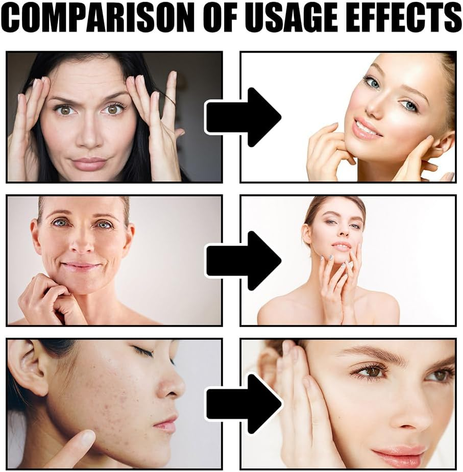 Dragon Blood Cream, Anti-Wrinkle Gel, Firming and Moisturizing Essence, Hydrating Film, Dragon Blood Skincare (Serum, 30Ml)