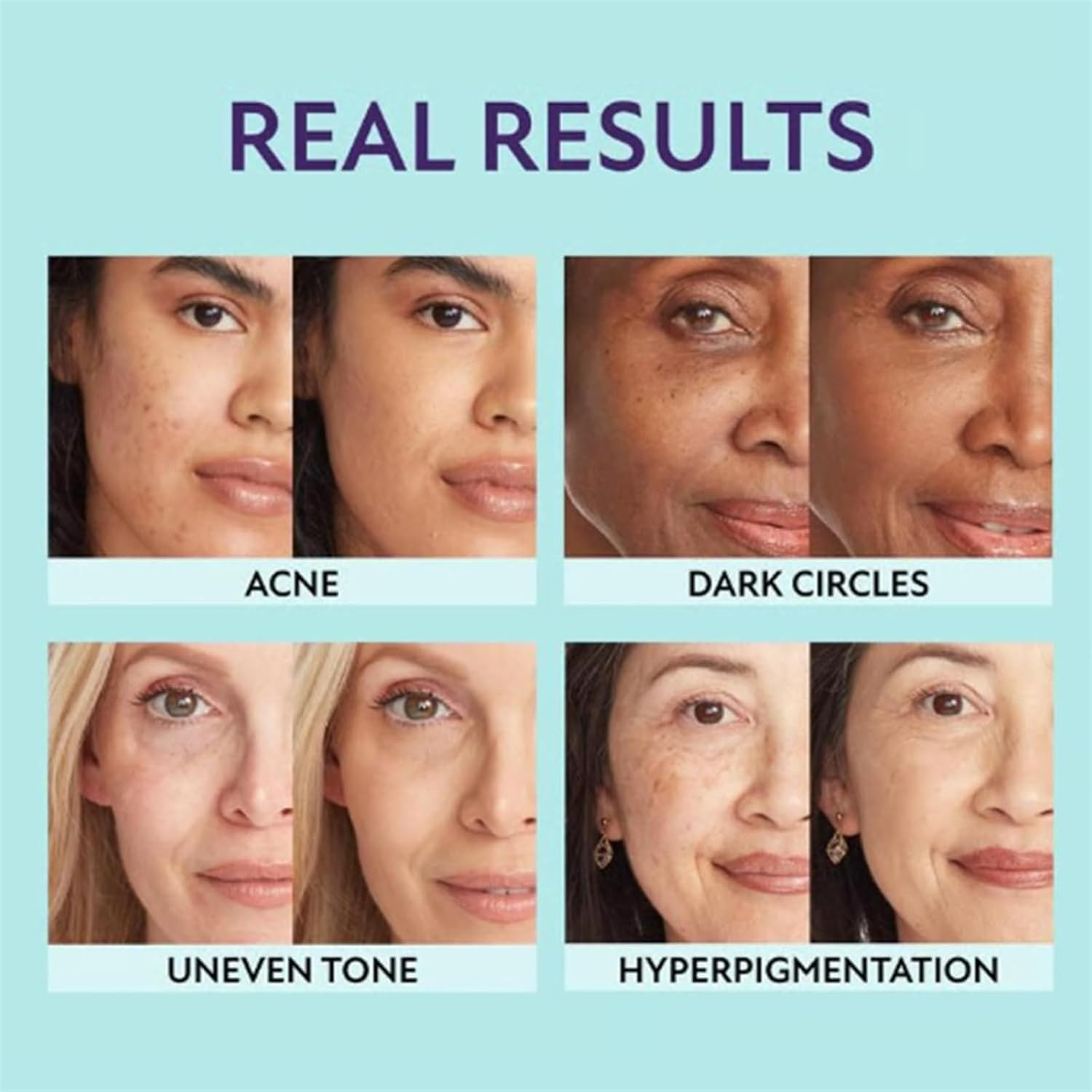 Korean Color Changing Cover Cream Stick, Color Changing Foundation Stick, Medium to Full Coverage Dewy Finish Base Makeup with Detachable Brush, Moisturizing Makeup (Medium) - Dark Skin image number 3