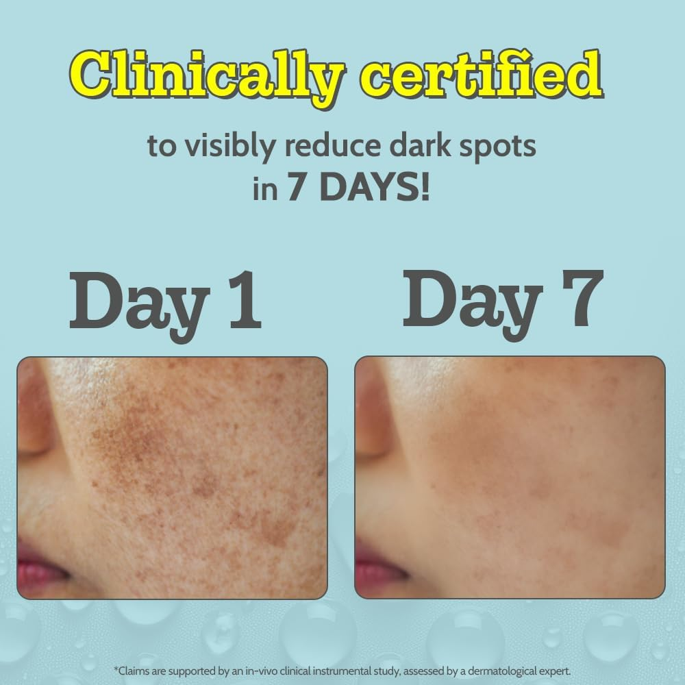 Chemist at Play 10% Vitamin C Face Serum | Brightens & Gives Glow | Fades Dark Spots | Treats Hyperpigmentation | Balances Melanin Production | Ethyl Ascorbic Acid & Glucosamine | for Oily image number 4