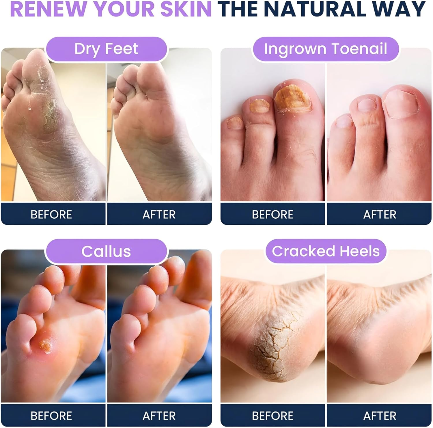 FOOT CURE Soothing Lavender Soak with Epsom Salt, Made in USA, Soak Soothes Sore Tired Feet, Athletes , Stubborn Odor, Softens Calluses & Helps Treat Toenail, 16 Oz,2 Pack