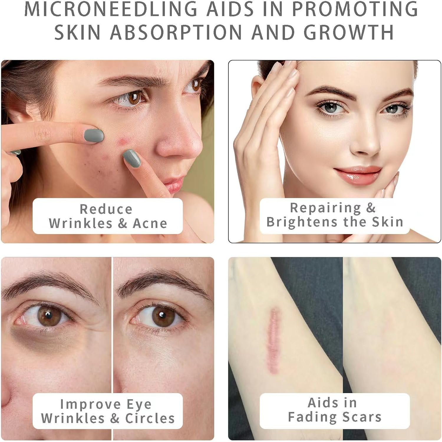 Zephyrcraft Derma Stamp Hair, Beard Growth Micro Elegant Pen for Body and Beard Growth, Lightweight, Micro Needle Stamp 0-3 Mm, 140 Grade a Titanium Needles, Dermastamp Adjustable image number 1