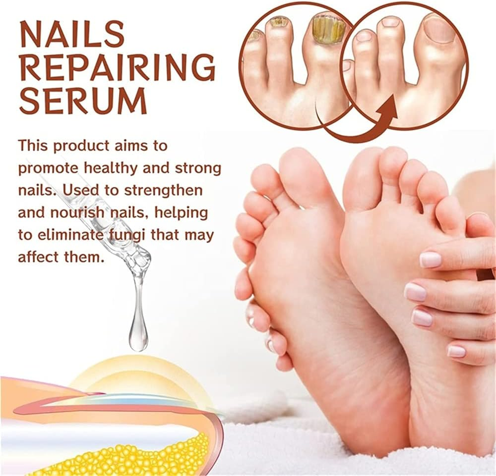 7 Days Nail Growth and Strengthening Serum, 20Ml Nail Growth and Strength Serum, Nail Growth & Strengthening Oil Serum, Stronger Nails in 1 Week Nail Strengthening Treatment (1Pcs) - 1Pcs image number 5