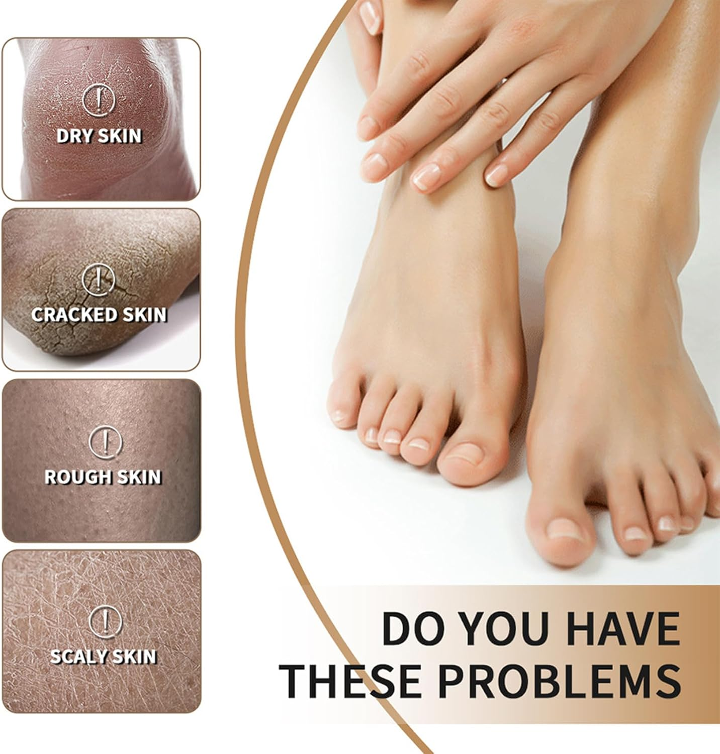 Intensive Foot Cream for Dry Rough & Cracked Bumpy Skin Moisturising Softens & Repairs Restores Ideal Skin Barrier for Heel and Foot Care