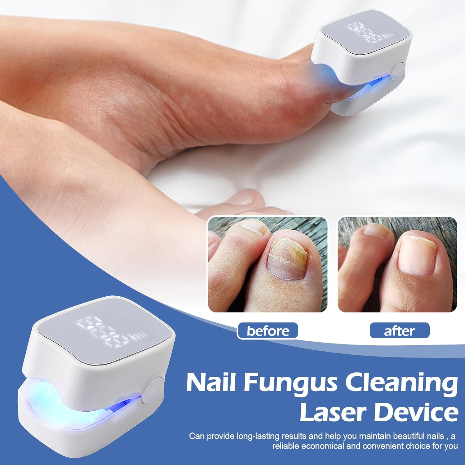 Nail Fungus Laser Treatment Device, Rechargeable Nail Fungus Laser for Fingers and Toenails, Portable Nail Cleaning Care Device, Highly Effective Nail Fungus Treatment (B) image number 2