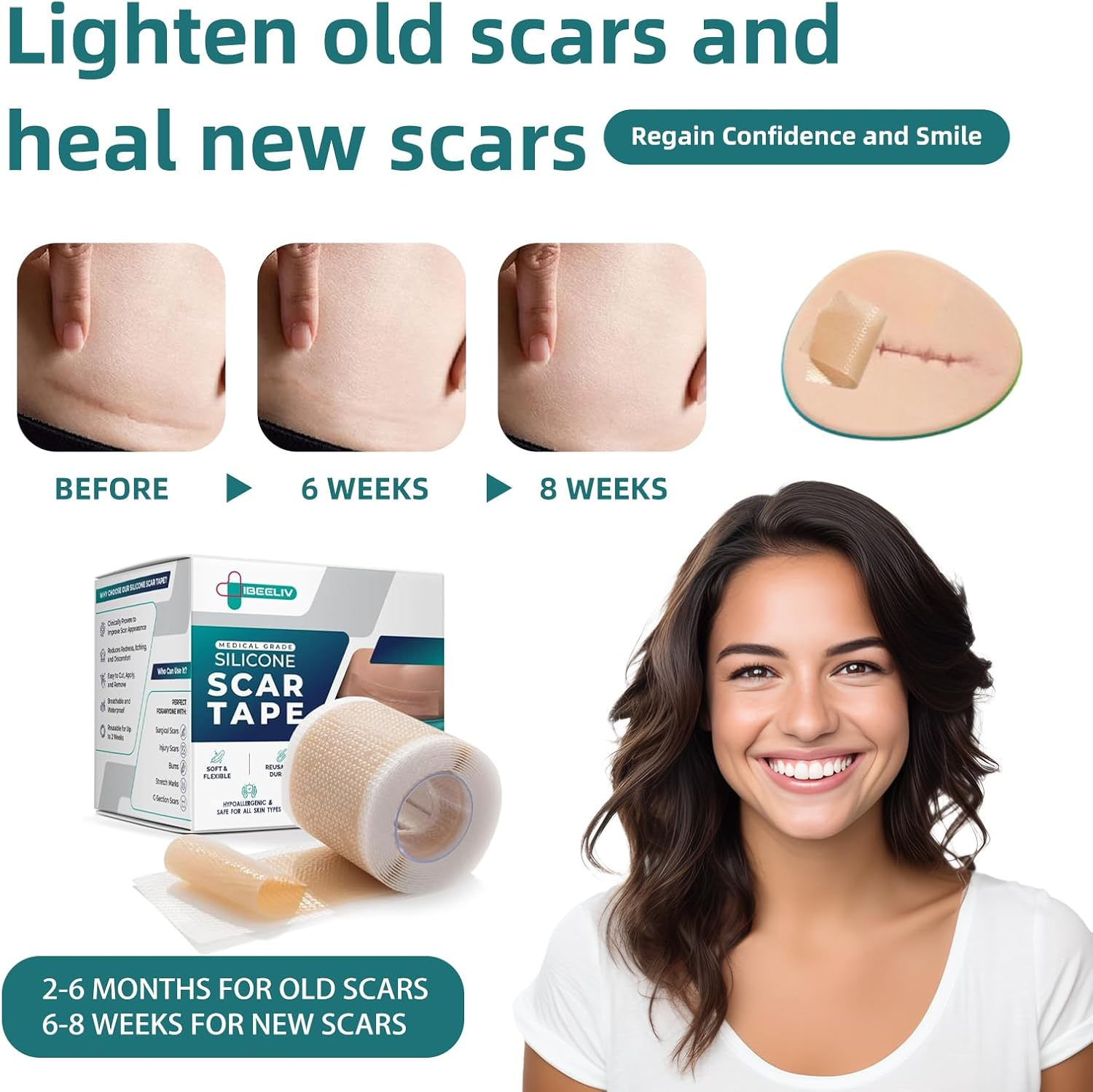 Silicone Scar Tape for Surgical Scars: Medical Grade Scar Gel Sheets for C-Section Tummy Tuck Recovery and Treatment &ndash; Reusable Scar Strips for Keloid Burn Acne Scars Removal (1.6'' X 60''Roll-1.5M) image number 2