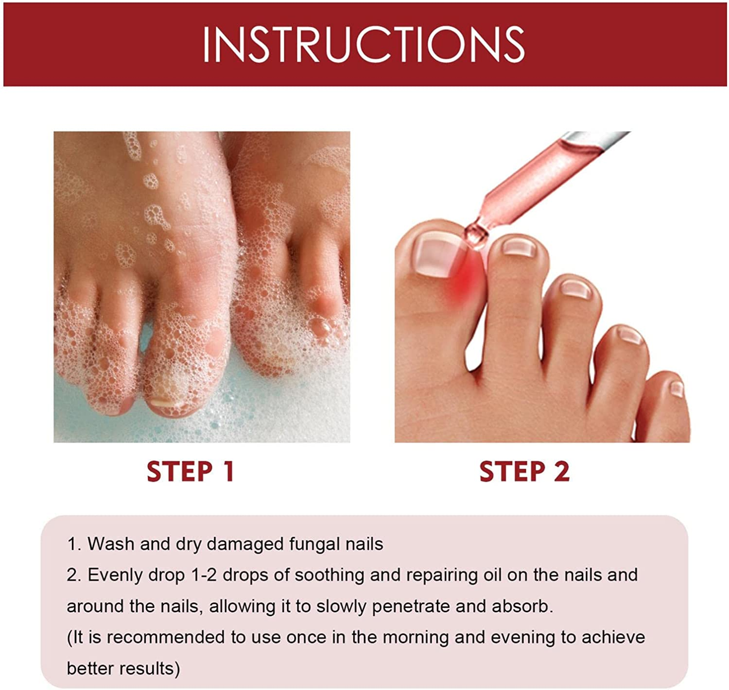 Anti Paronychia Relief Oil | Natural anti Paronychia Oil,Anti Paronychia Oil, Ingrown Toenail Removal, Paronychia Removal Oil for Damaged & Discoloration Nail image number 2