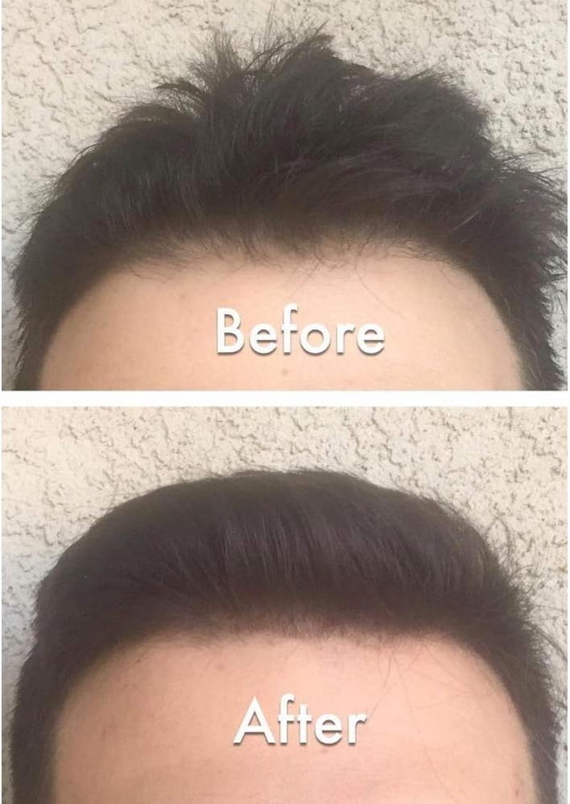 Nor1 Keratin Hair Building Fibers: Hair Fiber Filler and Thickener for Men and Women - Cover up and Concealer for Thinning Areas or Minor Bald Spot - Thicker, Fuller Hair in Seconds - 25 Grams - Dark Brown image number 4