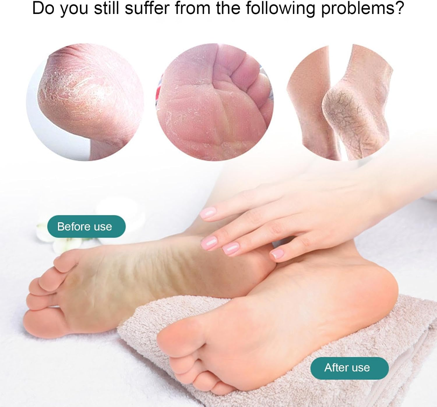 Glass Foot File Callus Remover,Clear Foot File | In-Shower Foot Scrubber Dead Skin Remover, Dry Heels Skin Remover Pedicure Kit for Feet Dead Skin Smoothing - C image number 6