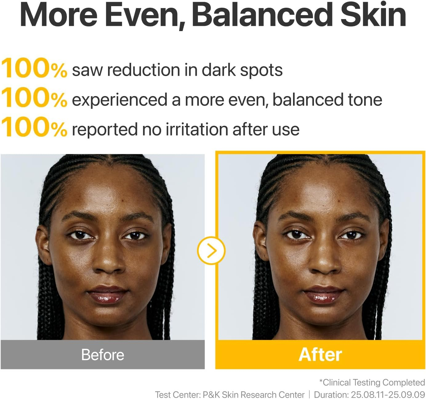 Numbuzin No.5 Serum | Glutathione TXA Advanced Dark Spot Ampoule Concentrate | Tranexamic Acid, Niacinamide | Hyperpigmentation| Suitable for Sensitive Skin, Korean Skincare | 10.7G image number 1