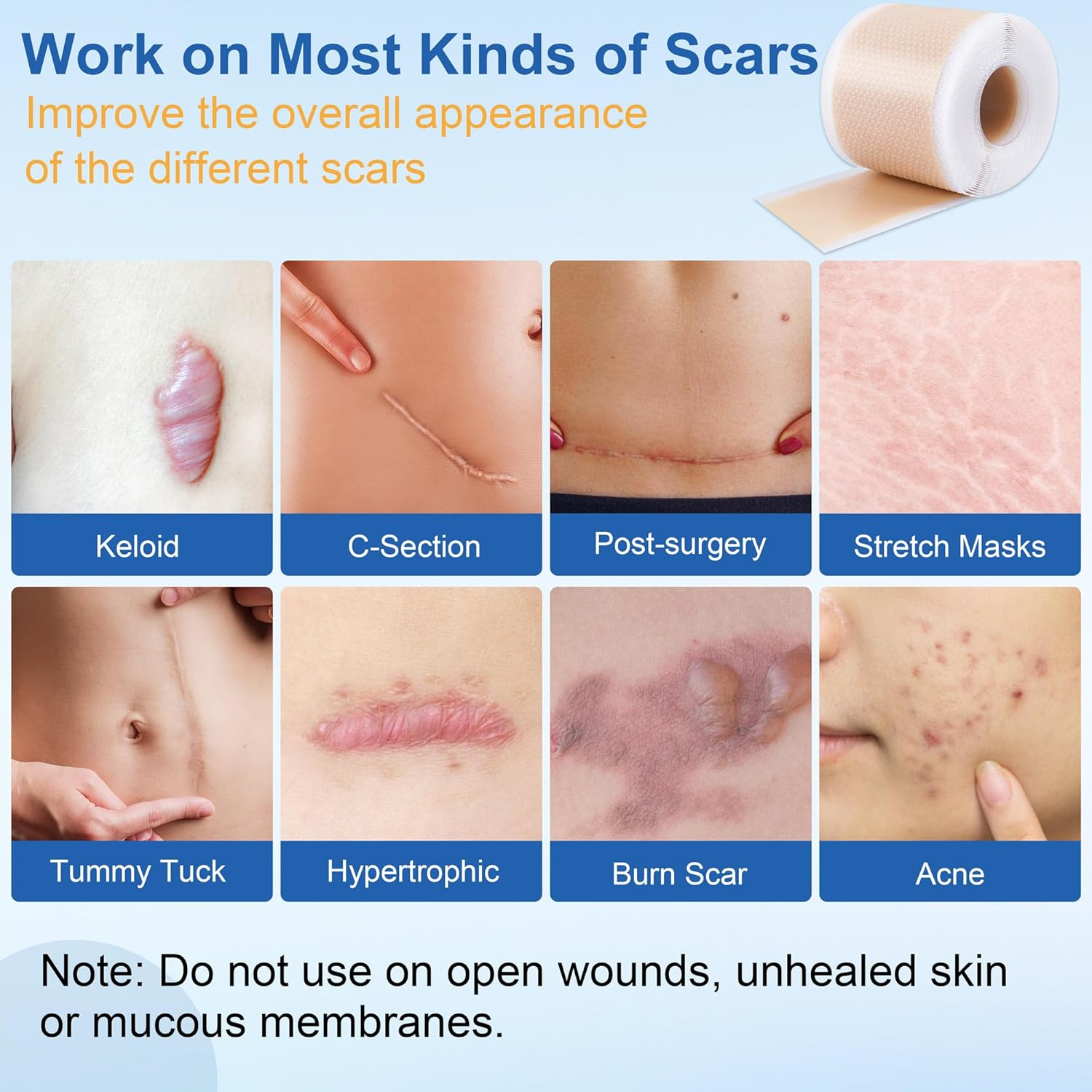 Silicone Scar Sheets - Silicone Scar Tape (1.6"X 60" Roll-150Cm) for Surgical Scars, C-Section, Keloid Scars, Hypertrophic Scars | Reusable Scar Strips