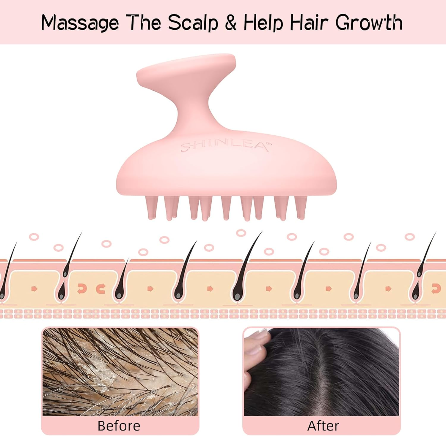 SHINLEA Silicone Scalp Massager Shampoo Brush, a Scalp Brush That Promotes Hair Growth and Removes Dandruff, Double Use of Dry and Wet image number 2