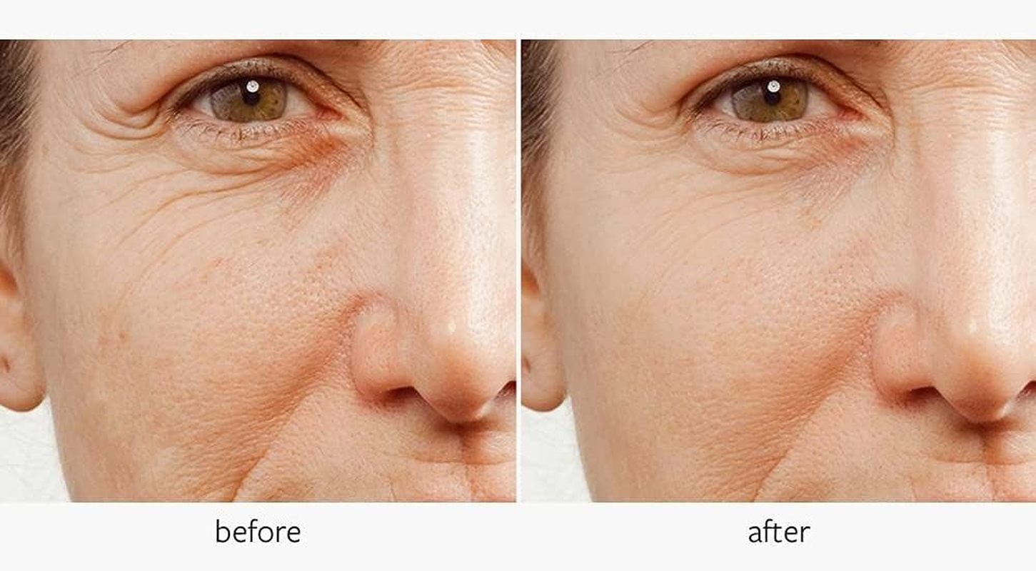 Freezeframe INHIBOX- Injection Free, Freeze Wrinkles, Smooth Lines, Ceramides, Wrinkle Relaxing, (10Mls) image number 1