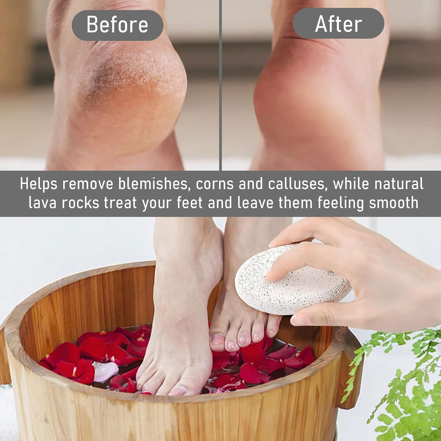 Pumice Stone Foot Care, Pumice Stone Callus Remover, Callus Removal, Pumice Stone, Foot Care, Lava Pedicure Tools, Natural Pumice Stone for Calluses and Hardening Removal for Feet and Hands, Pack of 2