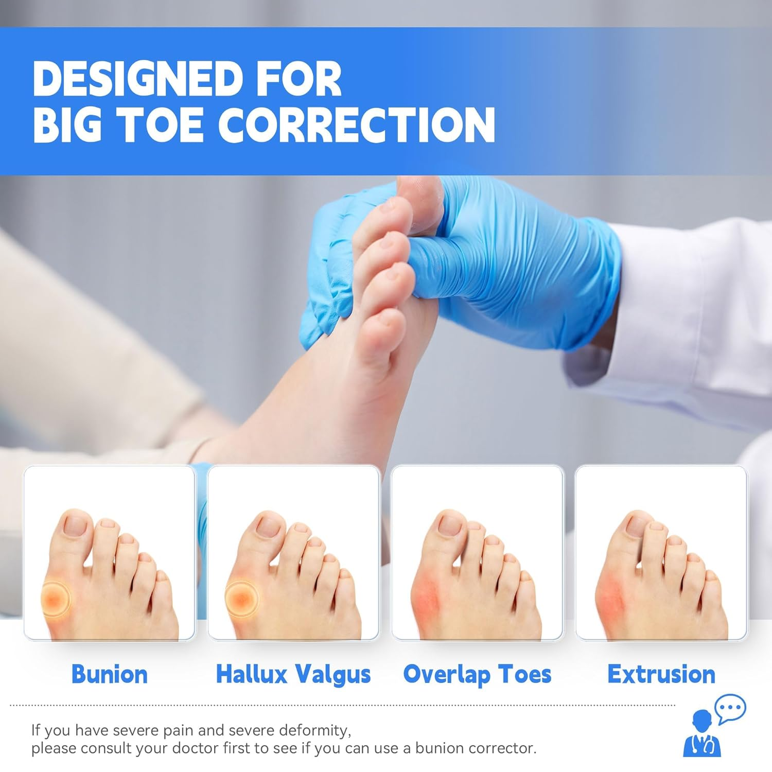 Bunion Corrector for Men & Women, Adjustable Bunion Splint, Big Toe Straightener Pain Relief, Suitable for Left/Right Foot Bunion (1Pcs,Gray) image number 2