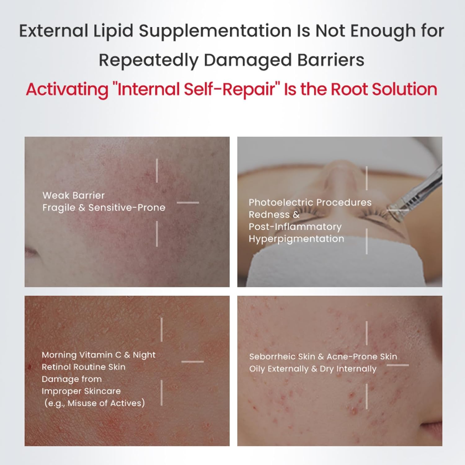 Winona Face Serum 1.5Ml&times;30, Barrier Repairing Essence for Sensitive & Fragile Skin, Single-Dose BFS Ampoule Design, Portable, Hydrating Repair Essence, Boosts Collagen & Strengthens Skin Barrier image number 1