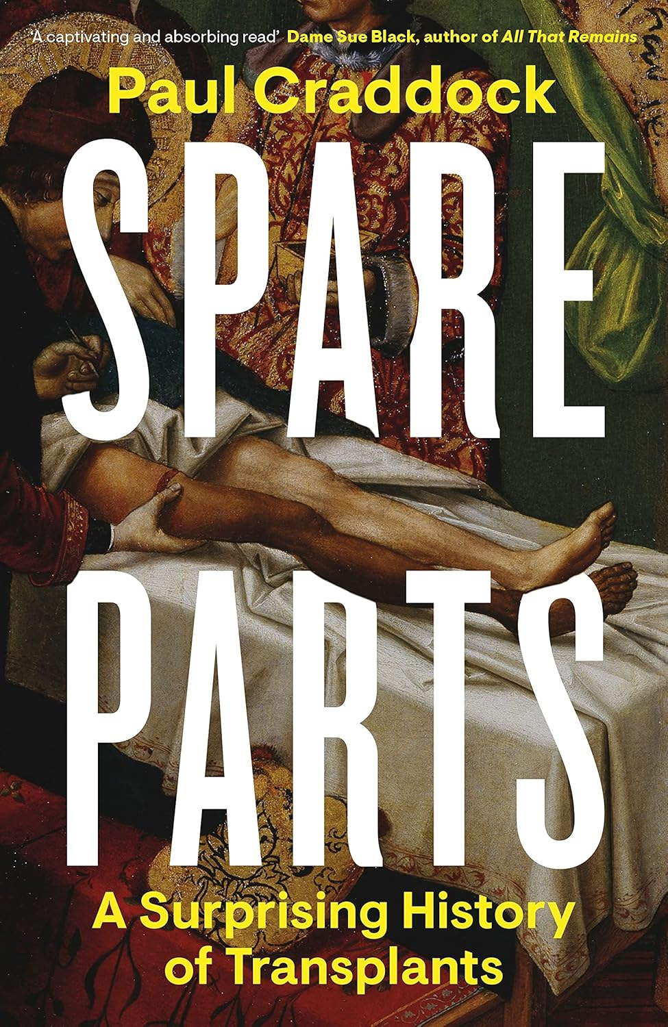 Spare Parts: a Surprising History of Transplants