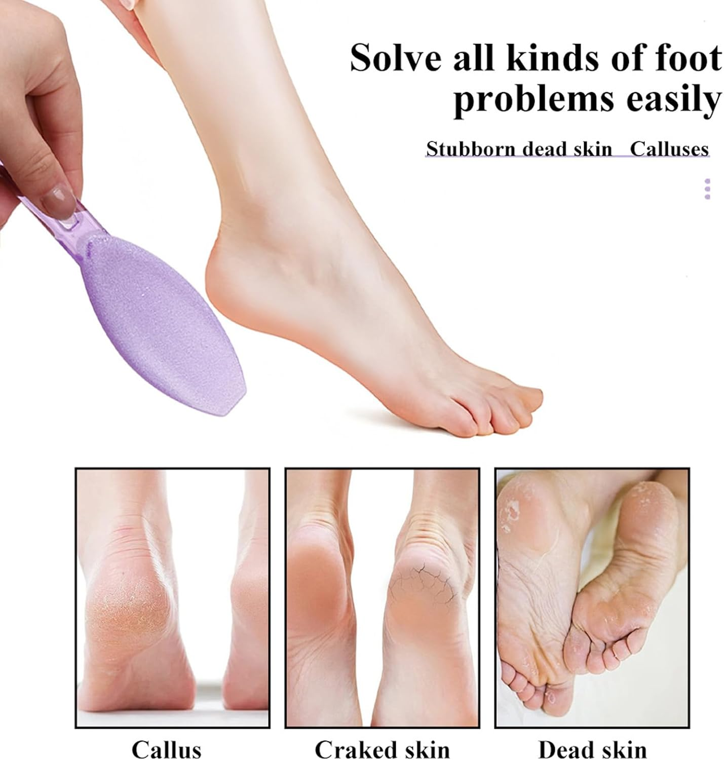 YUYTE Foot Scrubber File Pedicure Tool Ergonomic Multifunctional Foot Scraper with Comfortable Handle for Home and Nail Salon Use Pack of 3 image number 2