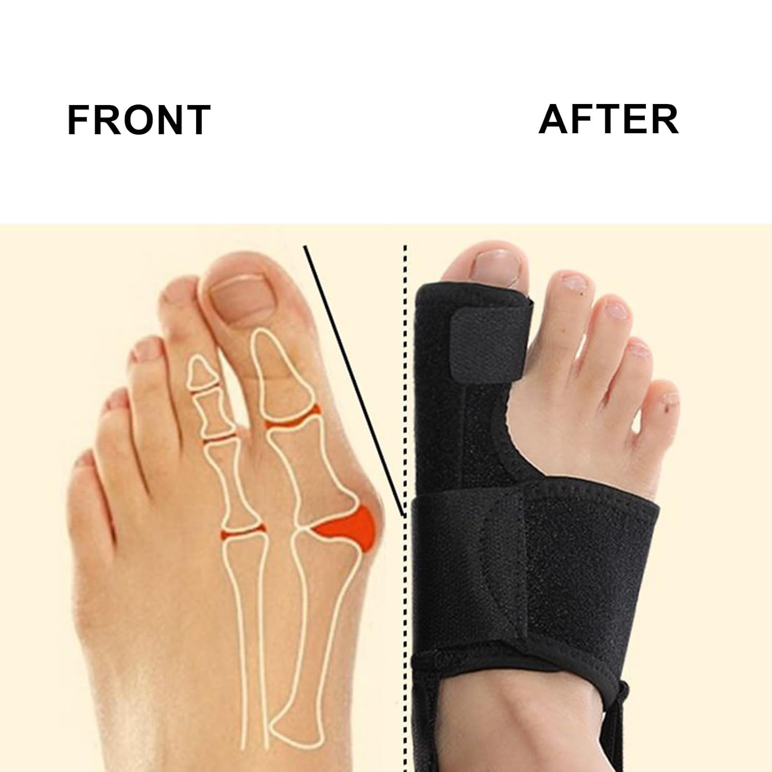 Toe Straighteners for Curled | Adjustable 2 Piece Toe Straightener,Anti-Slip Breathable Ergonomic Correction Protector for Men Home Yoga Pedicure image number 2