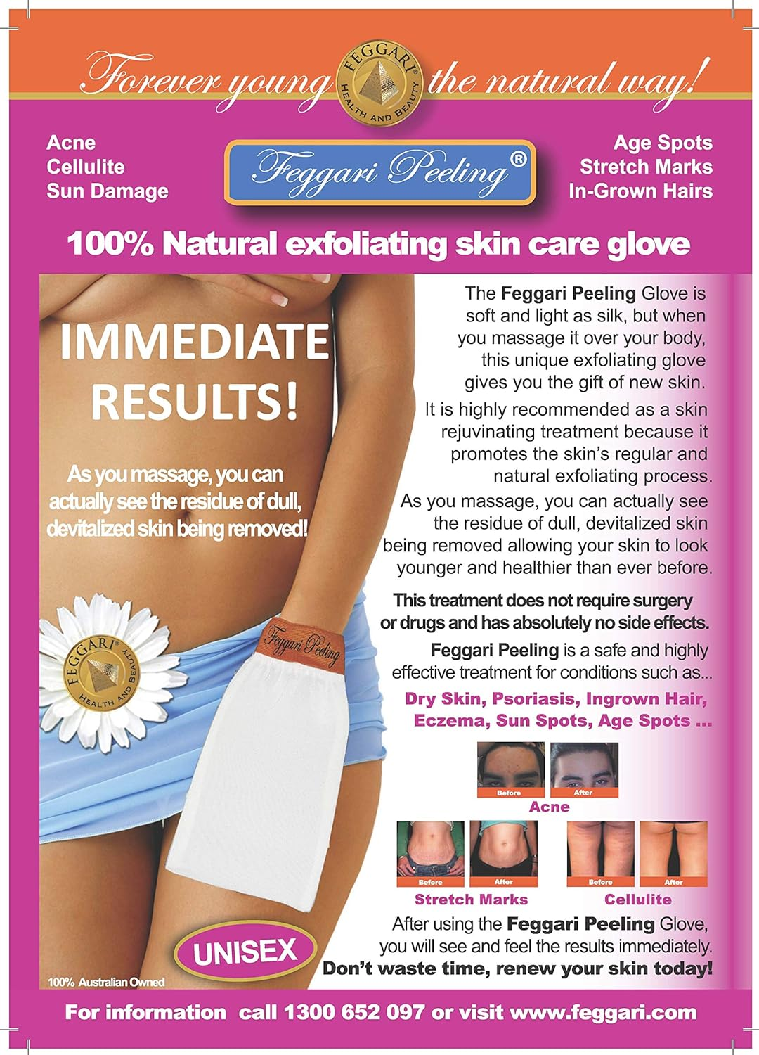 Feggari Peeling Exfoliating Glove image number 2